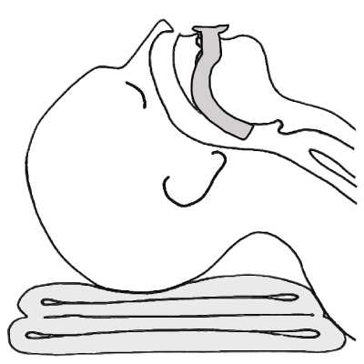 Voies respiratoires oropharyng&eacute;es