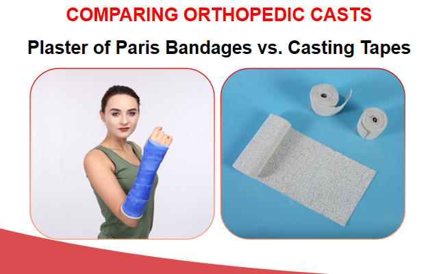Différences entre les bandages en plâtre et les bandes de moulage